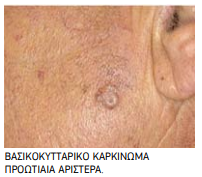 ΦΩΤ 1 ΔΕΡ.PNG