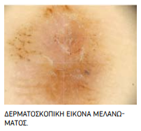ΦΩΤ 3 ΔΕΡ.PNG